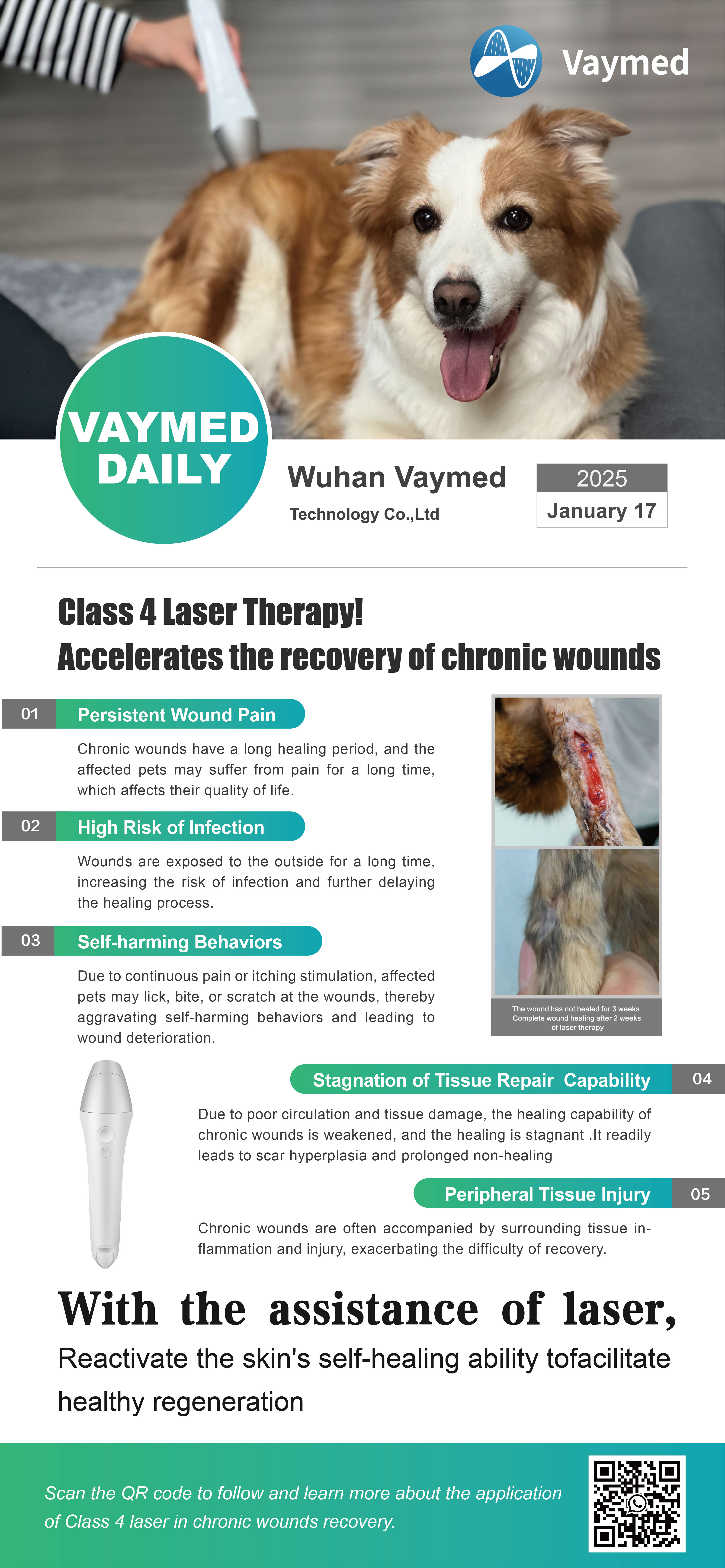 Class 4 Laser Therapy & Dangerous of Chronic Wounds