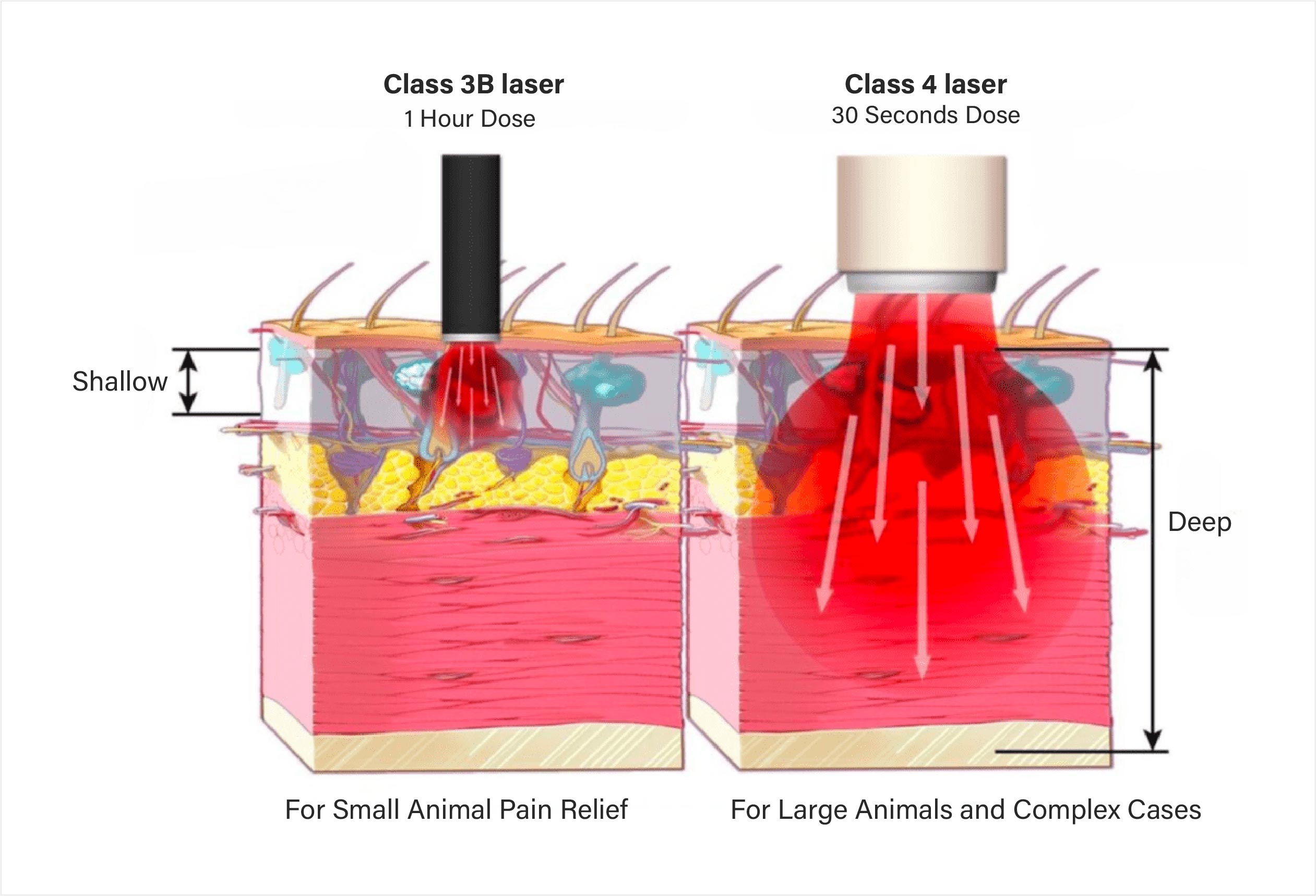 What is the Difference Between Class 3B Laser and Class 4 Laser?