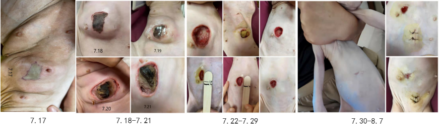 A Case of Laser Treatment of Feline Mammary Ulceration.png