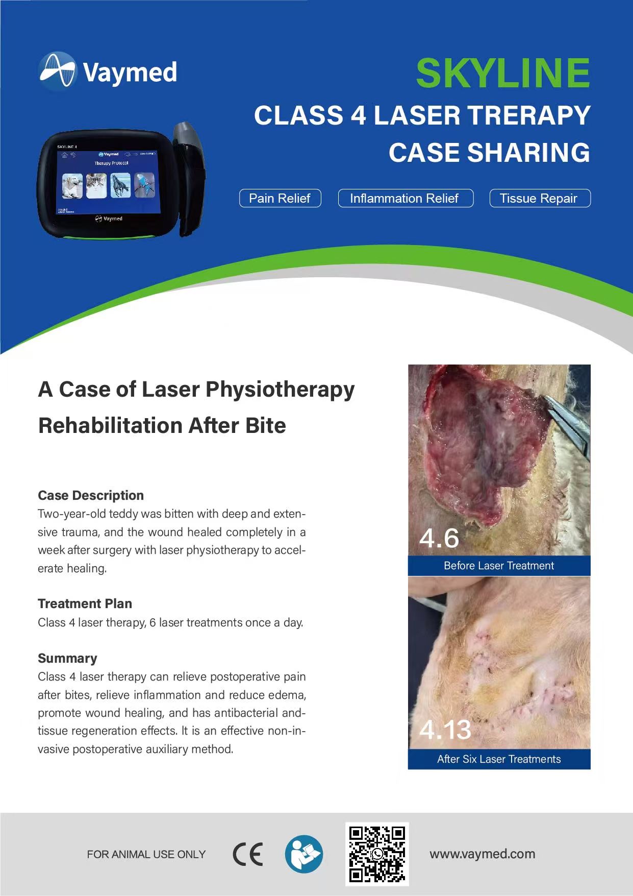 A Case of Laser Therapy Rehabilitation After a Bite
